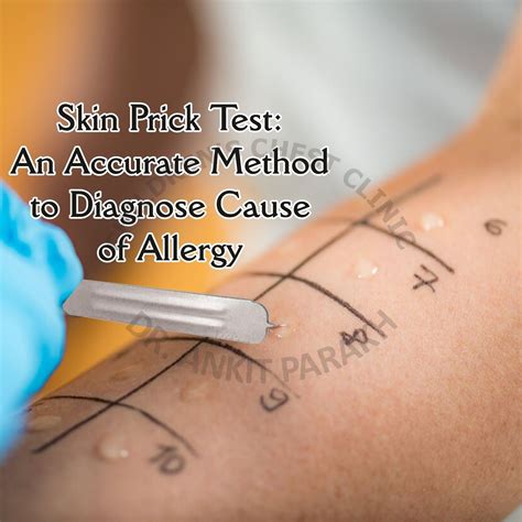 blood drop finger prick allergy testing|skin prick test.